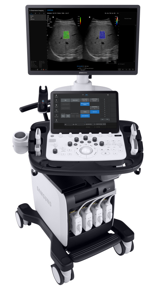 삼성메디슨이 새롭게 출시한 고급형 초음파 진단기기 V8. <삼성메디슨 제공>